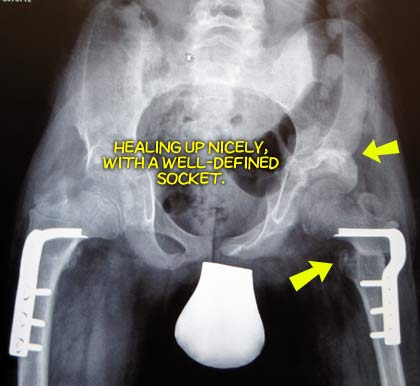 xray today