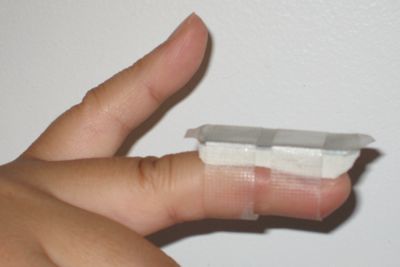 My teeny-tiny splint