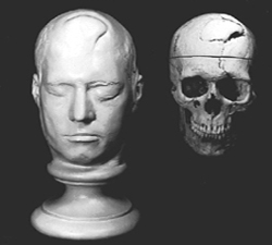 Phineas Gage Lifemask and skull